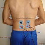 Electroestimulacion y electroestimuladores para quitar contracturas y dolor de espalda. Tens. Cefar, compex, globus. Electroestimulacion y electroestimuladores para quitar contracturas. Tens. Cefar, compex, globus.